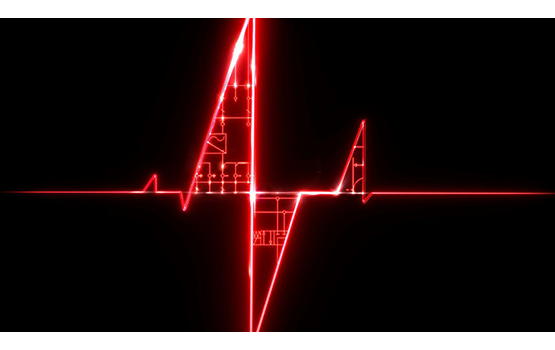 Eplan Epulse red heart pulse